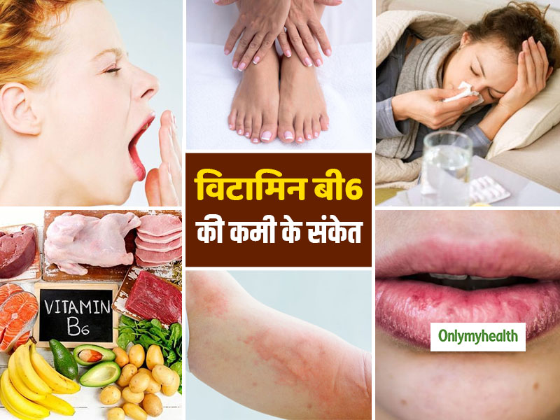 Vitamin B6 Deficiancy Signs: सुबह-सुबह जी मिचलाना, फटे होंठ हैं विटामिन बी 6 की कमी का संकेत, जानें कैसे पूरी करें इसकी कमी